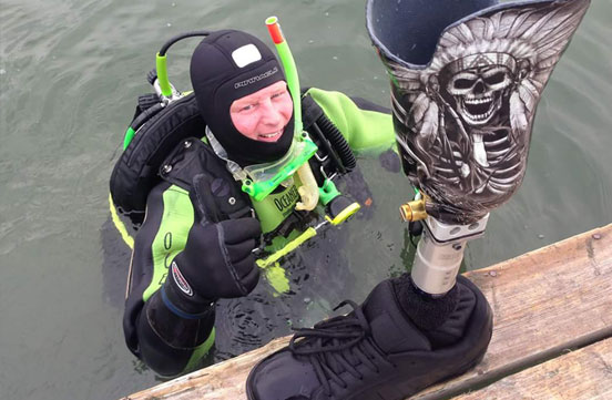 Dive Shop helping to recover lost artificial leg in Chestermere Lake